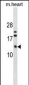 FXYD7 Antibody (N-term)